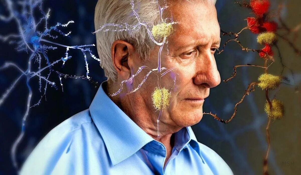Деменция головы. Память у пожилых людей. Мозг человека в старости. Старение головного мозга.