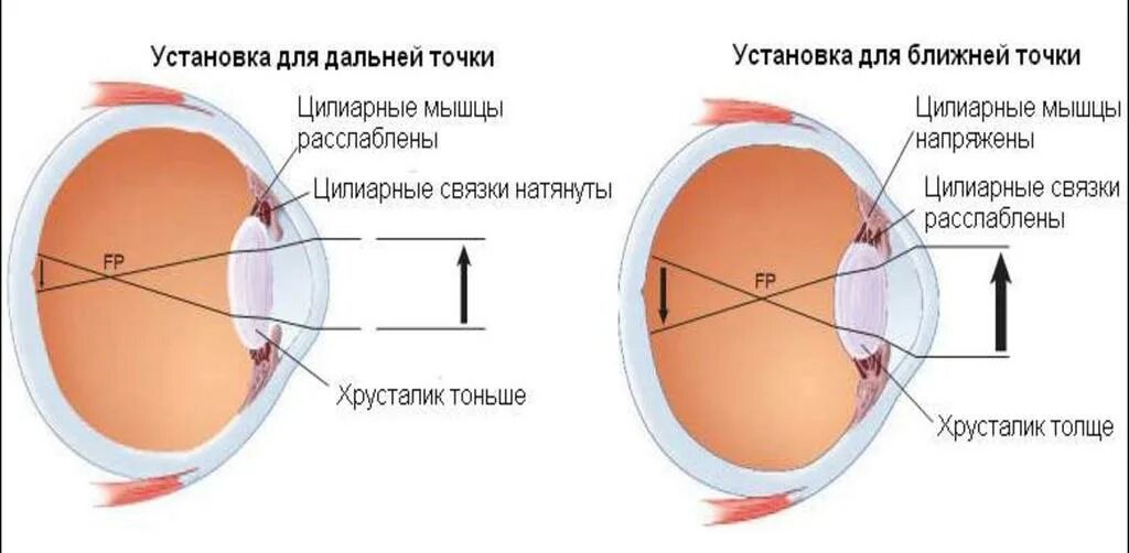 Снятие спазма аккомодации. Аккомодация хрусталика глаза. Процесс аккомодации глаза. Спазм аккомодации. Аккомодационные структуры глаза.