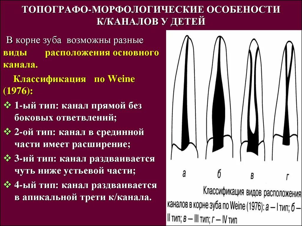 Классификация конфигураций корневых каналов. Типы конфигурации корневых каналов по Вертуччи. Классификация Вейне корневых каналов. Формы корневых каналов