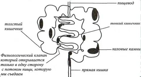 Каловые камни в кишечнике