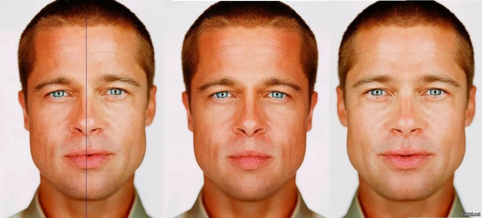 Асимметрия лица. Коррекция асимметрии лица. Асимметрия глаз. Что значит ассиметрично. Энн хэтэуэй асимметрия.