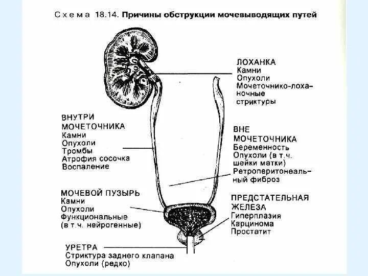 Устье мочеточника схема. Устье мочеточника анатомия. Отделы мочеточника анатомия. Шейка мочевого пузыря у мужчин на схеме.