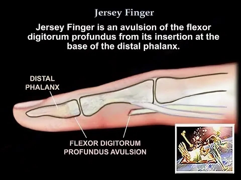 Жест большой палец. Finger everything. Жесты руками. Finger everything. Мизинцы мирись.