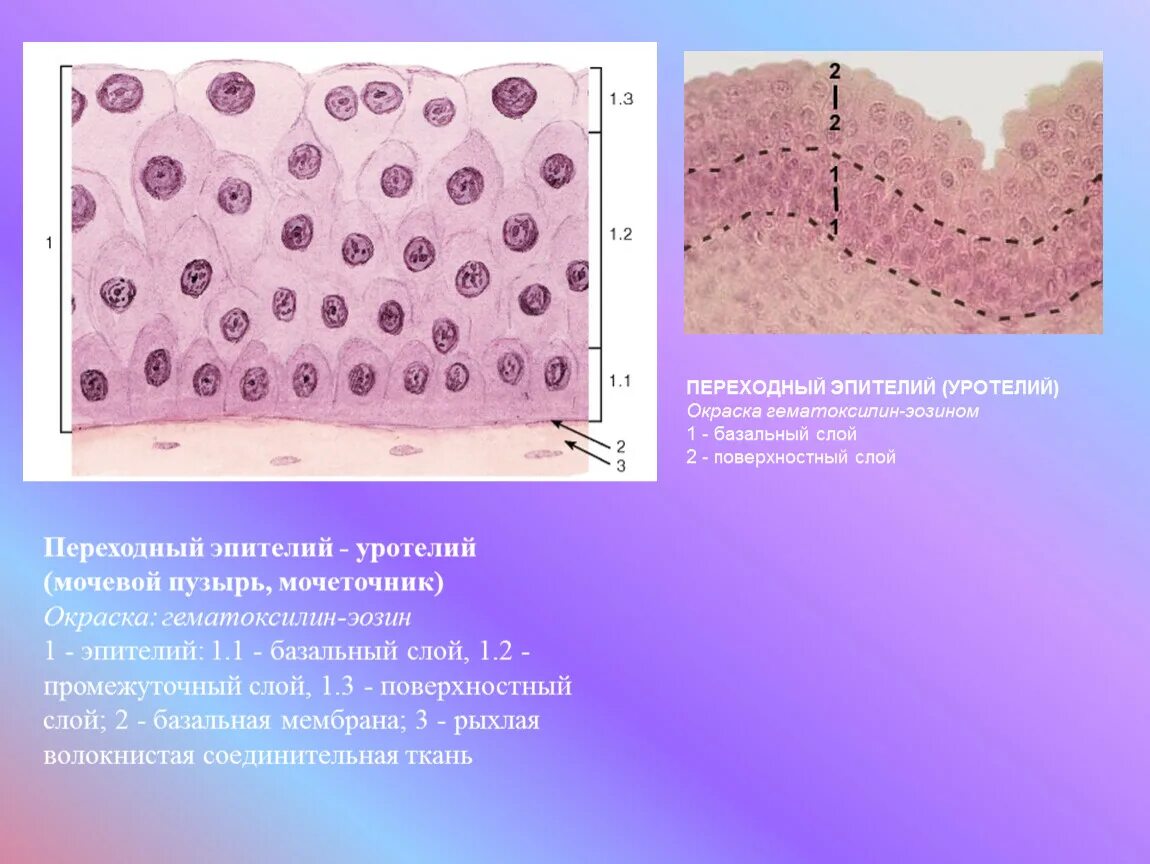 Слои переходного эпителия. Переходный эпителий уротелий. Многослойный эпителий мочевого пузыря. Переходный эпителий мочевого пузыря. Многослойный переходный эпителий мочевого пузыря.