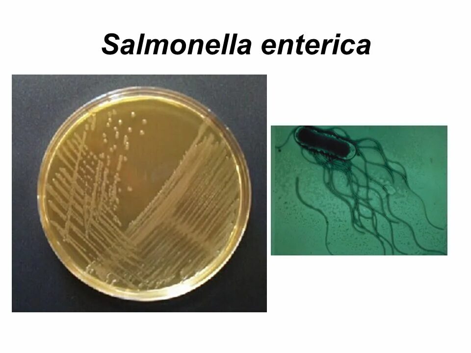 Salmonella enterica. Сальмонелла энтерика микробиология. Salmonella enterica морфология. Сальмонелла пуллорум микроскопия. Сальмонелла Тифи микробиология.