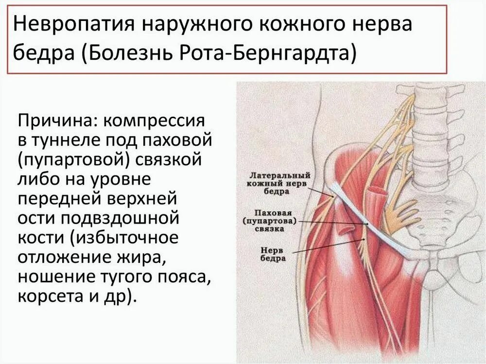 Наружный кожный нерв бедра