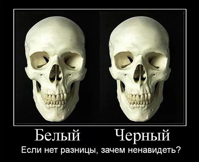 Отличать белое от черного. Череп белого и черного человека. Расовые различия черепа.