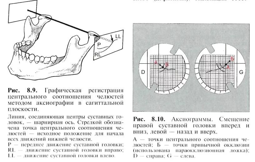 Центральное соотношение челюстей ВНЧС. Шарнирное движение суставной головки ВНЧС. Центральное соотношение челюстей и шарнирная ось. Суставная щель ВНЧС размер. Сагиттальный размер канала норма