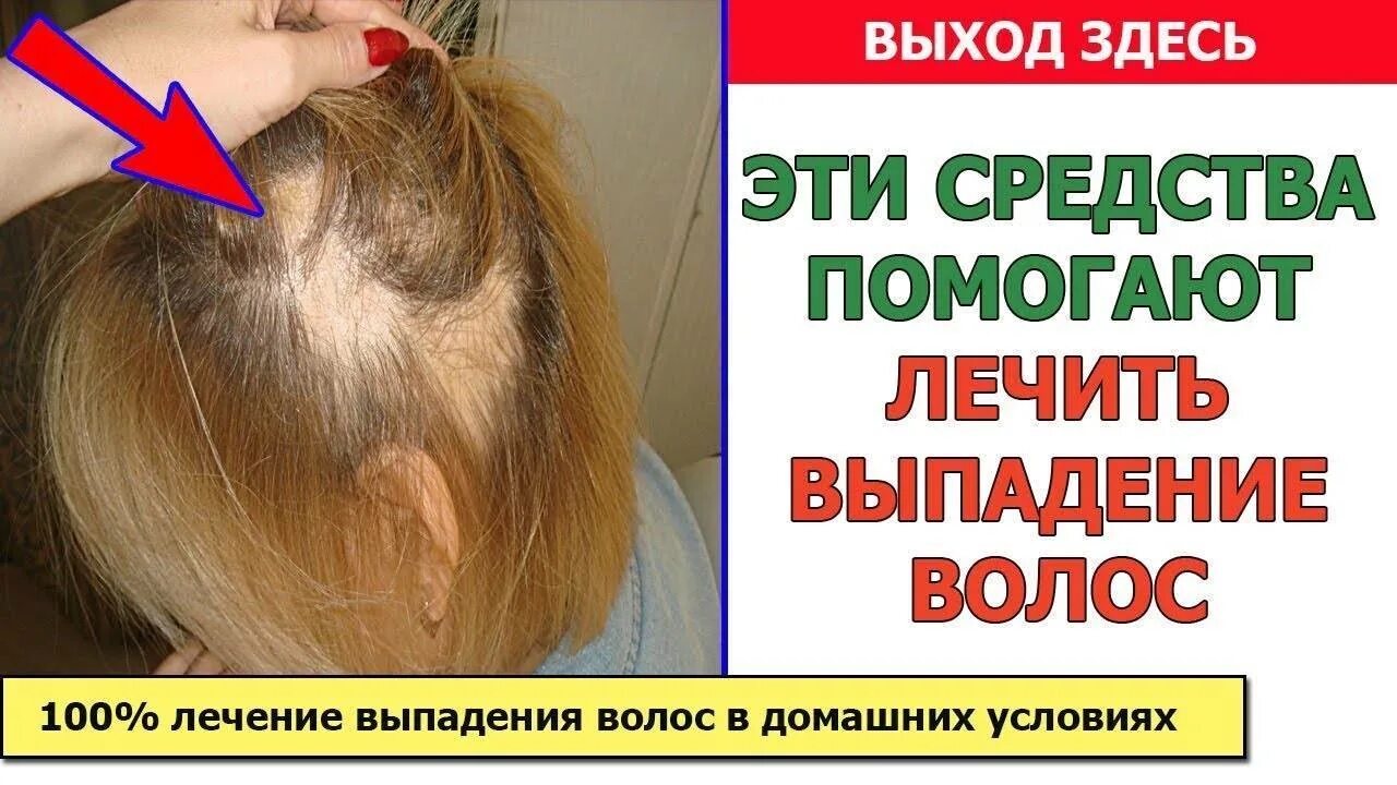 Отечность выпадение волос