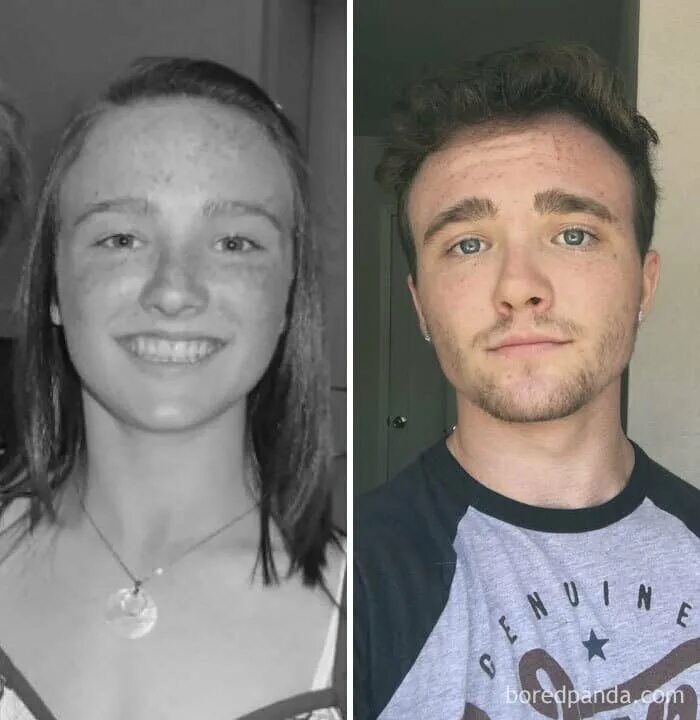 До и после смены пола. Операция по перемене пола. Смена пола. Гормонотерапия до и после. Мужики изменившие пол.