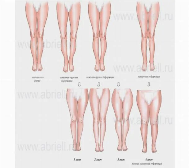 Идеальная форма ног. Форма женских ног. Форма ног у женщин. Форма ног у женщин. Форма ног.