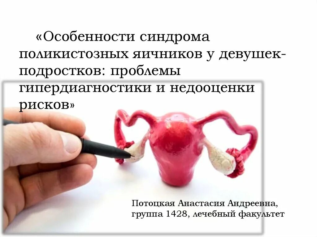 Лечение яичников у девушек. Синдром поликистоз яичников. синдром поликистозных яичников у подростков. синдром поликистозных яичников симптомы.