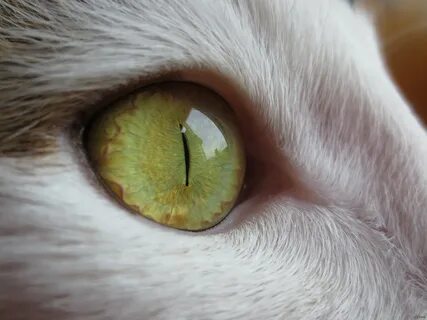 Кошачьи глаза у человека