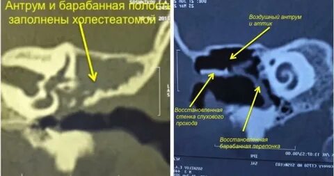 Операция кт