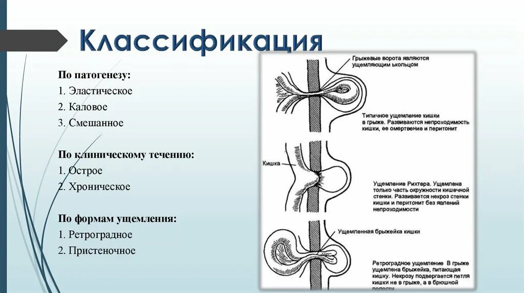 Ущемленная брюшной грыжа. Ущемленная грыжа этиология. Патогенез ущемленной грыжи живота. Клинический симптом ущемленной грыжи. Ущемленная наружная грыжа живота: этиология.