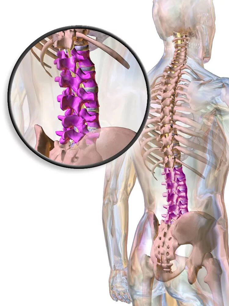 Симптомы поясничного крестцового отдела позвоночника. Грыжа позвоночника. Междисковые грыжи поясничного отдела позвоночника. Грыжа крестцового отдела позвоночника. Позвоночная грыжа поясничного крестцового отдела.
