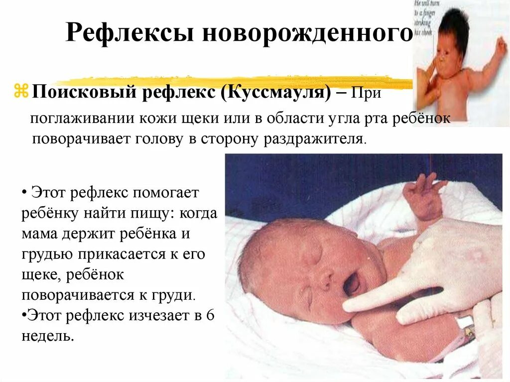 Поисковый и хоботковый рефлекс у новорожденного. Поисковый рефлекс Куссмауля. Поискоаый рефлект кусамауля. Рефлекс Куссмауля у новорожденных.