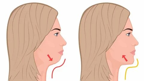 Here are effective exercises and home remedies to get rid of double chin. 