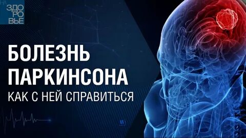 Лечение паркинсона в спб
