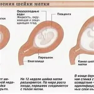 Как прощупать беременность на ранних сроках самой