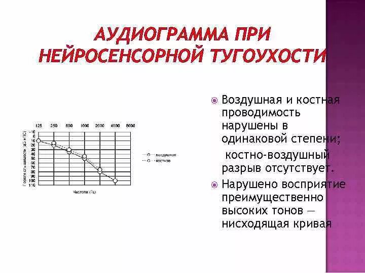 Симптомы тугоухости у взрослых. Аудиограмма 4 степени тугоухости. Нейросенсорная тугоухость 2 степени аудиограмма. Аудиограмма сенсоневральная тугоухость 1 степени. Аудиограмма при нейросенсорной тугоухости 2 степени.