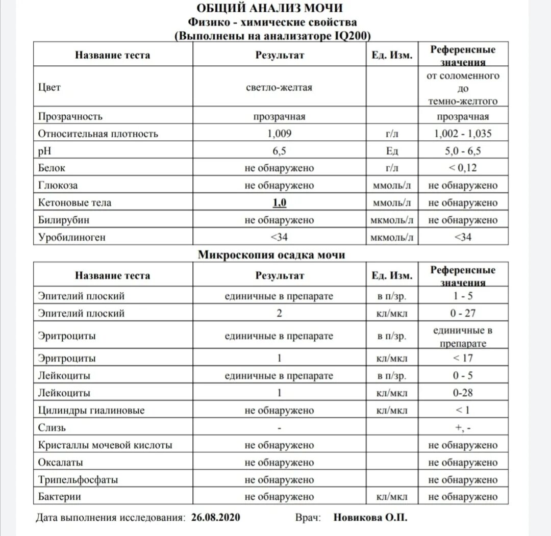 Кетоновый белок в моче. Общий анализ мочи показатели нормы у детей. Анализ мочи норма у детей 5 лет. Показатель общего анализа мочи в норме у ребенка 11 лет. Анализ мочи расшифровка у детей 6 лет норма в таблице.