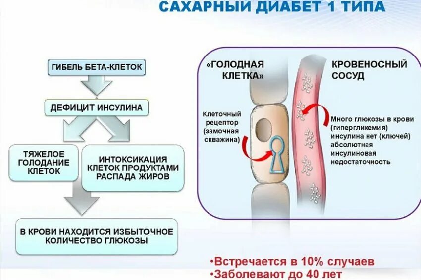 Сахарный 1 типа. Причины сд 1 типа. сахар при сахарном диабете 1 типа. формы сахарного диабета 1 типа. причины сахарного диабета 1 типа.