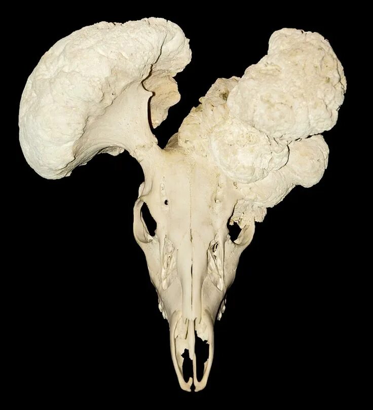 Череп существа. Остеосаркома черепной кости. Остеосаркома костей черепа кт. Остеогенная саркома костей череп.