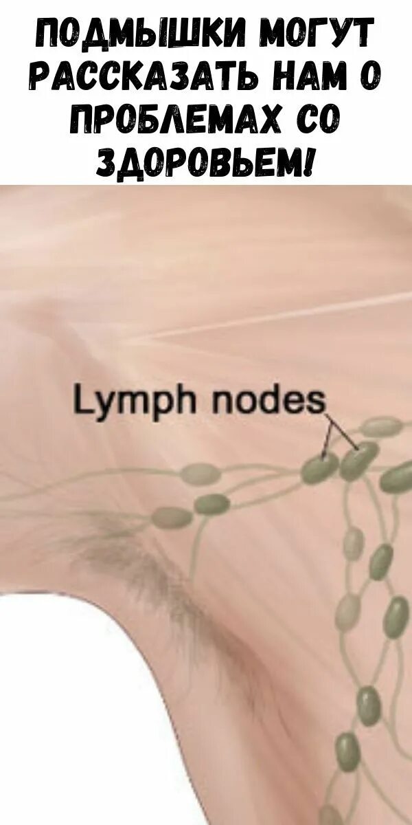 Лимфоузлы под мышками расположение у женщин. Схема расположения лимфоузлов подмышками. Расположение лимфоузлов под мышкой. Подмышечные лимфоузлы расположение. Подмышечные лимфатические узлы расположение.