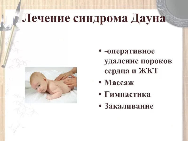 Синдром дауна пороки сердца. Синдром дауна лечение. профилактика синдрома дауна. методы профилактики синдрома дауна. профилактика болезни синдрома дауна.