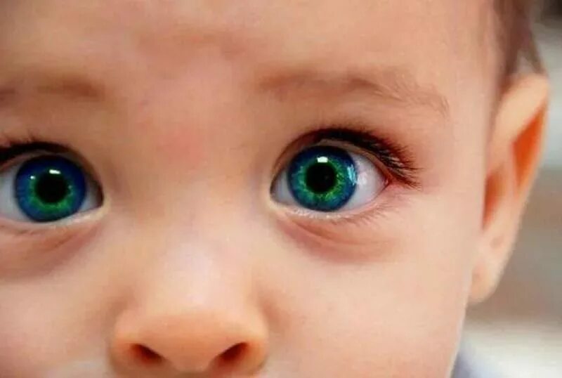 Мальчик индиго. Янтарные глаза. Ретинобластома лейкокория. Врожденная катаракта ретинобластома. Симптом кошачьего глаза ретинобластома.