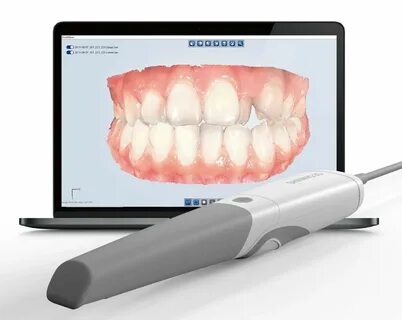 Ambient light illuminance for Intraoral scanner may maximize scanning accur...