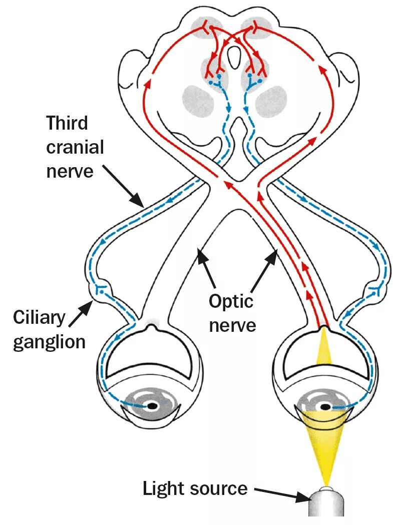 Зрачковый рефлекс схема. Схема рефлекторной дуги зрачкового рефлекса. Дуга зрачкового рефлекса схема. Дуга зрачкового рефлекса на свет.