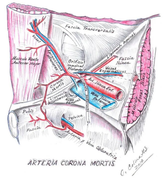 Паховая складка у мужчин. Венец смерти топографическая анатомия. Корона смерти бедренная грыжа. Корона Мортис анастомоз. Corona Mortis топографическая анатомия анастомоз.