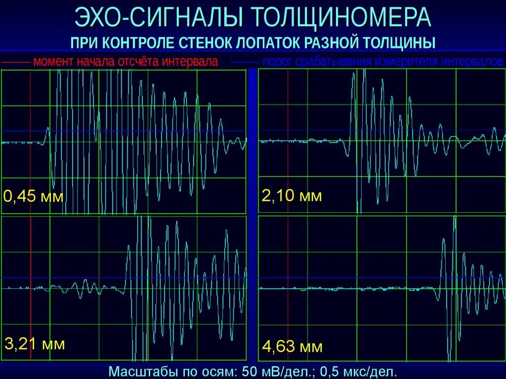 Эхо сигнал. Отображение эхосигналов на мониторе. Модель Эхо сигнала. Режимы Эхо сигнала.