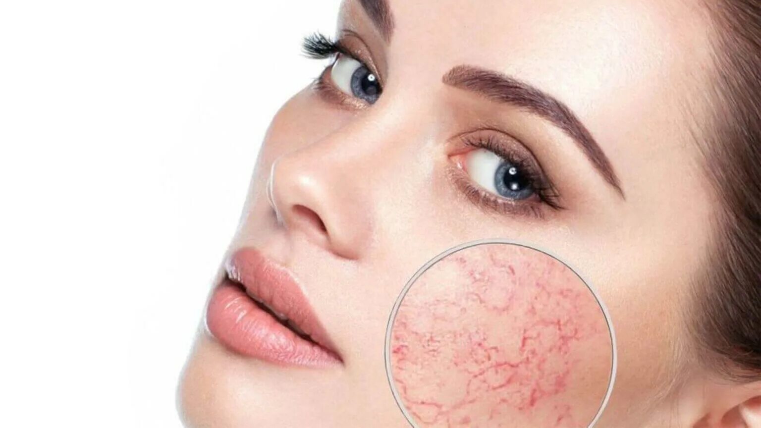 Омоложение сосудов