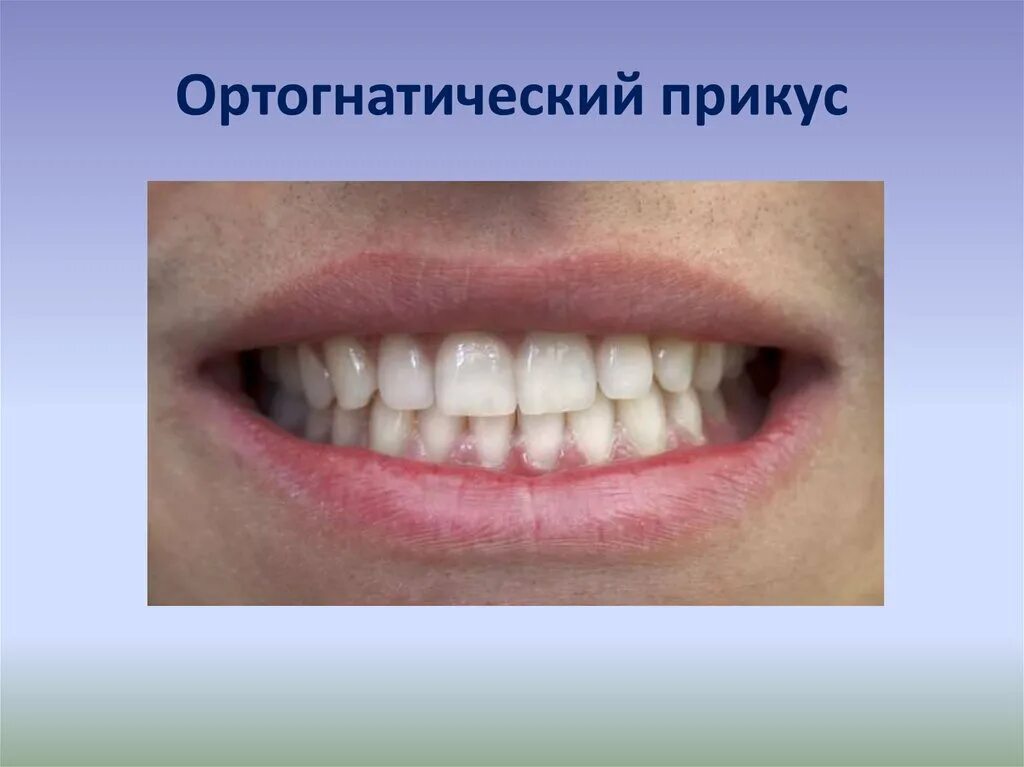 Какие должны быть зубы у человека. Ортогнатический прикус зубы. правильный ортогнатический прикус. ортогнатический, прогенический, прямой прикус. привкус ортогнотический.