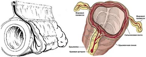 Перекрут подвесок кишки
