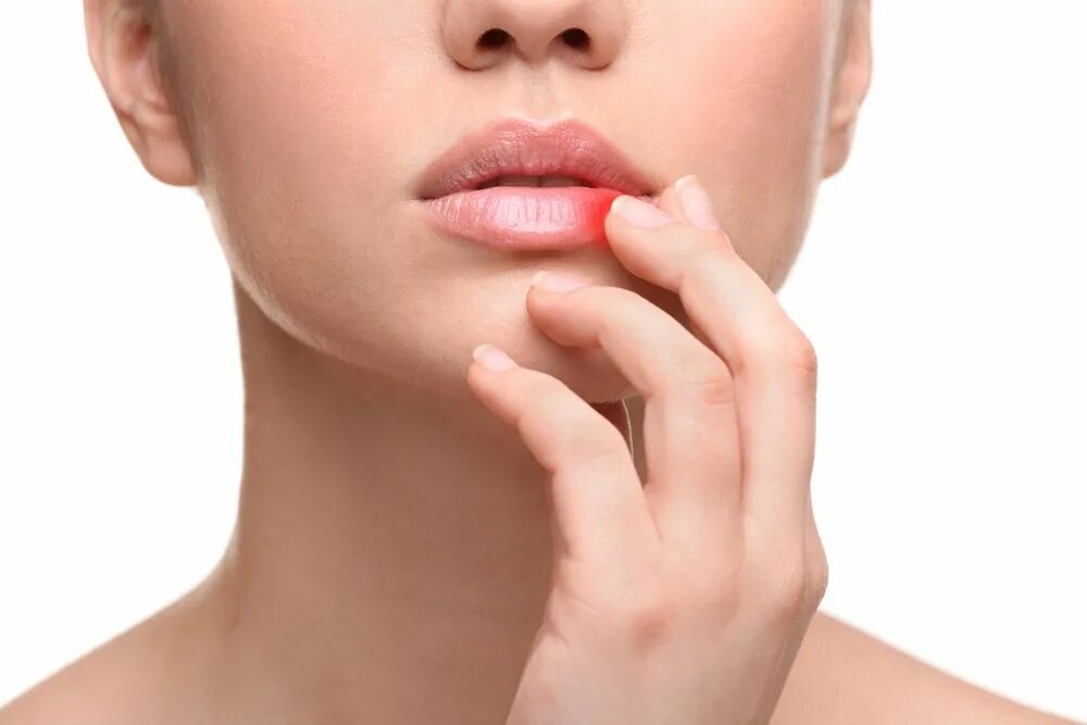 Ранняя стадия герпес ранняя. Прикусывание губы. Soft lips. Боль на губах рта. Герпес после татуажа губ.