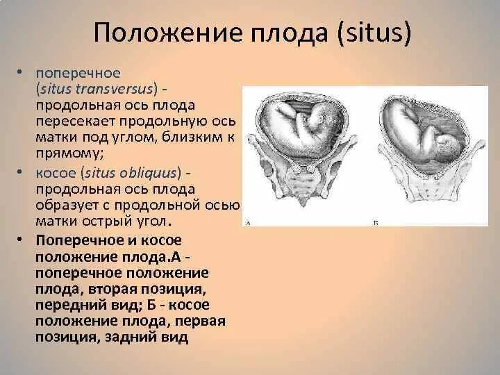 Положение плода в матке продольное. Поперечное положение плода. Продольное и поперечное расположение плода. Положение и позиция плода.