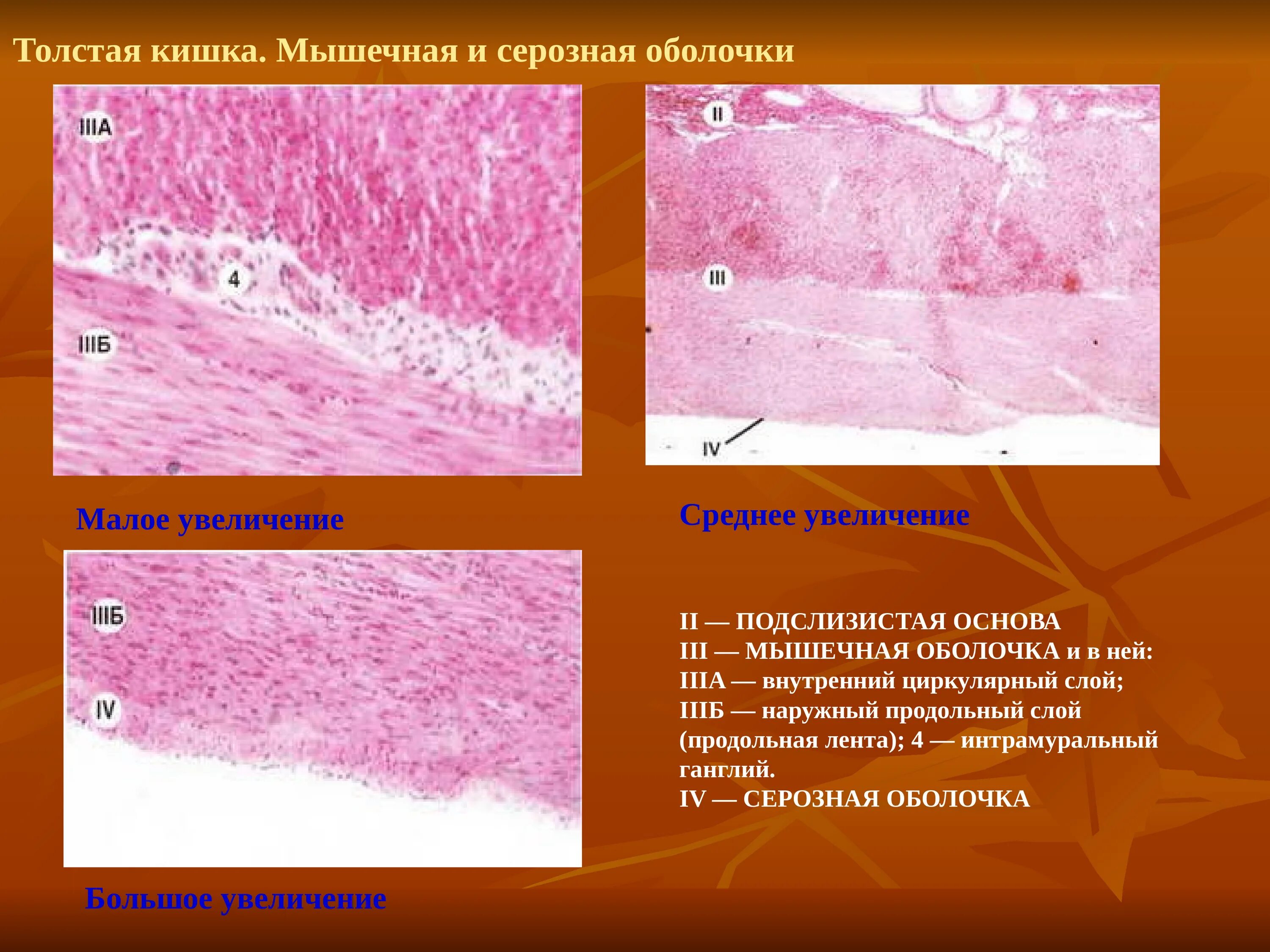 Оболочки толстой кишки гистология. Интрамуральный ганглий толстой кишки. Мышечная оболочка толстой кишки гистология. Серозная оболочка гистология. Серозная и слизистая оболочка