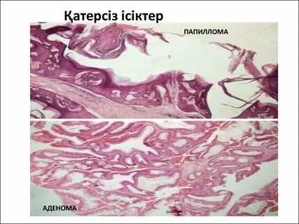 Cuckold gang bang порно нұсқалары