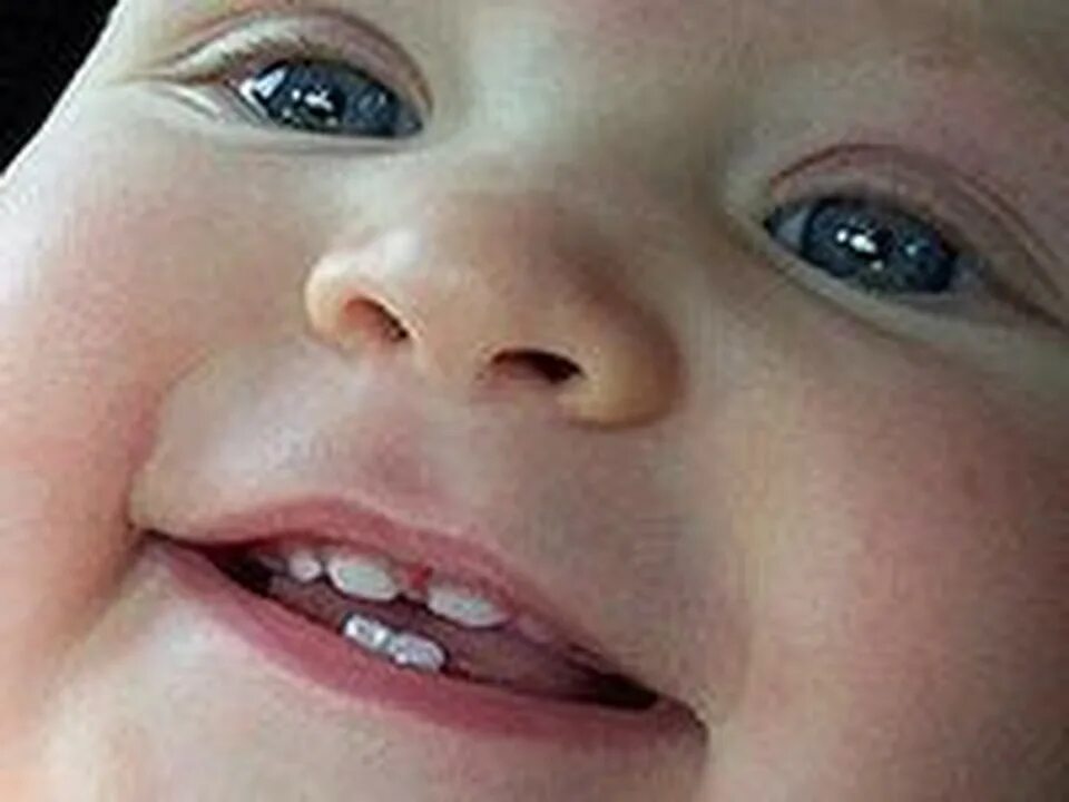 Первые признаки вылезания зубов у грудничка. Зубы у 9 месячного ребенка. Последовательность появления молочных зубов у детей. Зубки у малышей порядок прорезания схема. Зубы у 9 месячного ребенка.