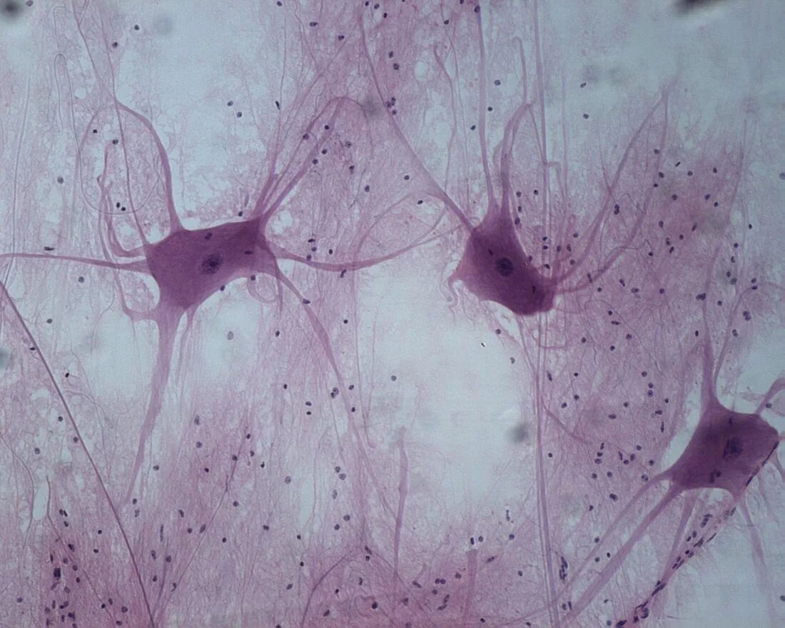 Увеличение больших половых. Нейроглия гистология препарат. Нервная ткань человека микропрепарат. Нервная ткань микрофотография. Клетки нейронов гистология.