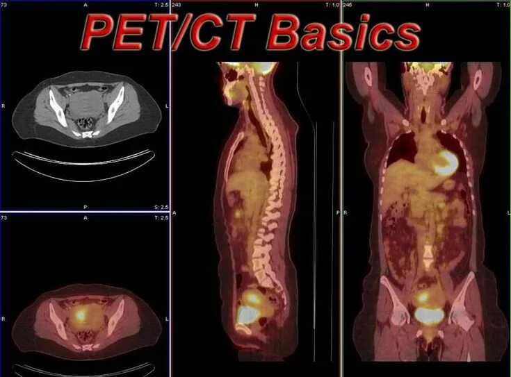 Pet ct. ПЭТ кт Pet CT. Pet-CT. Pet-CT У животных.