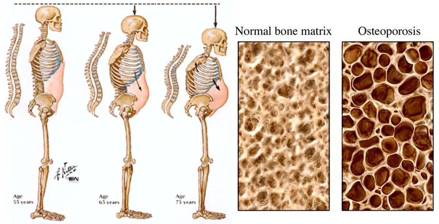 Bone mineral