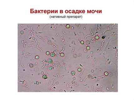 Бактерии в моче два плюса