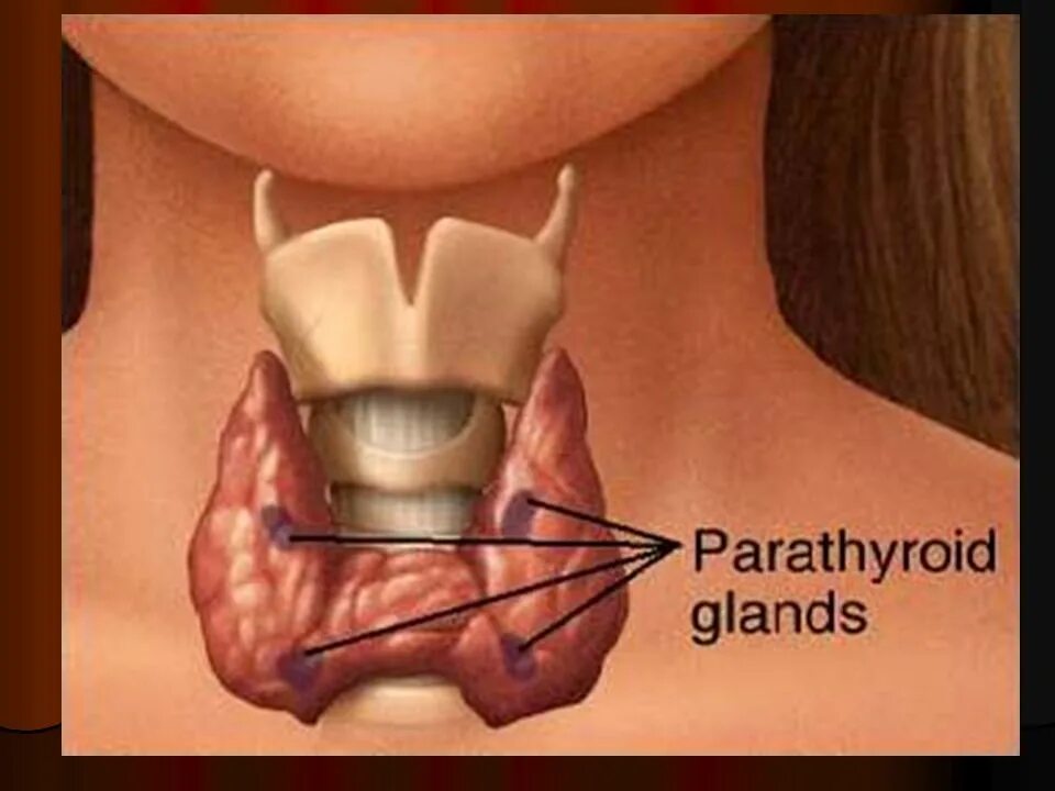 одноузловой эндемический зоб.