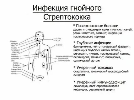 Стрептококковая инфекция симптомы у женщин