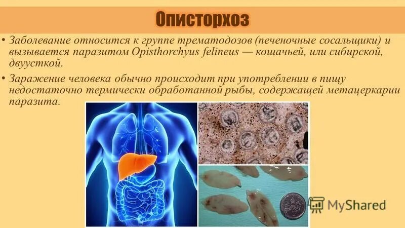 механизм заражения печеночным сосальщиком. ареал распространения печеночного сосальщика. заражение человека печеночным сосальщиком возможно если. пути заражения человека печеночным сосальщиком. печеночный сосальщик способ заражения.